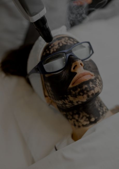 carbon-facials