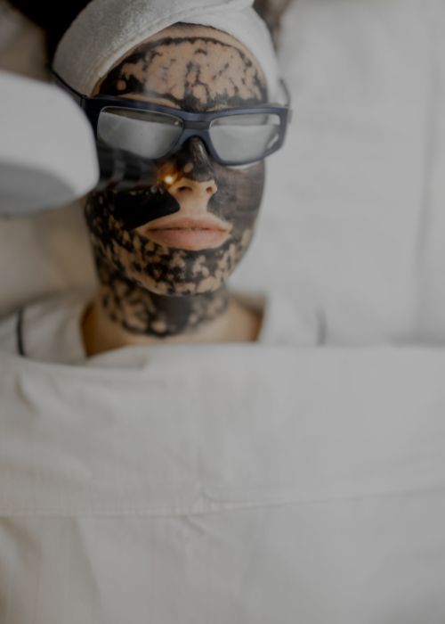 carbon-facials-aftercare