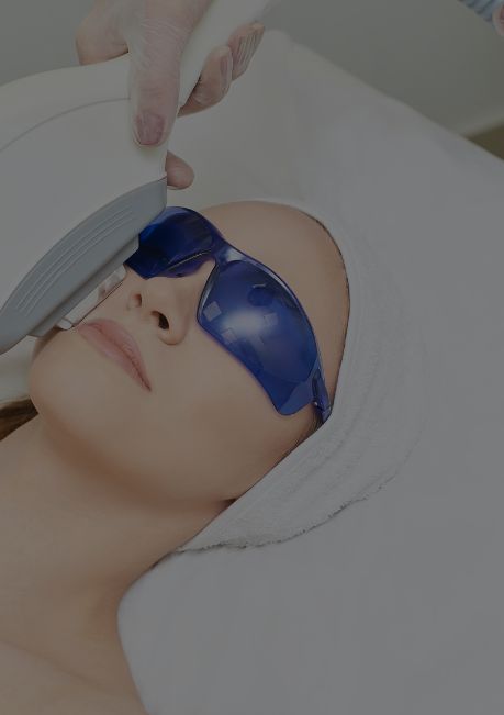 laser-facials