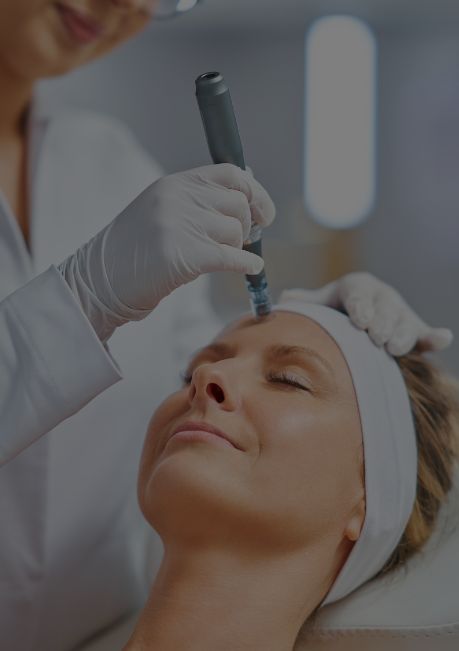 skin-needling