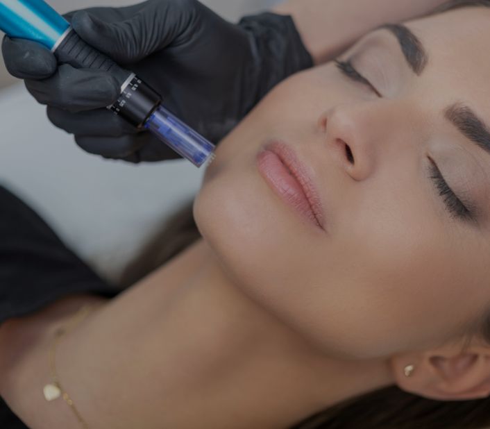 about-skin-needling
