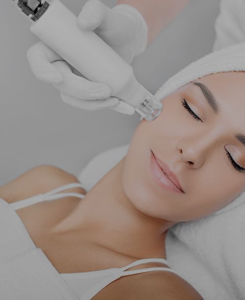 benefits-of-skin-needling